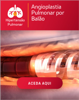 Folheto Informativo: Angioplastia Pulmonar por Balão